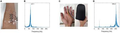 Relief of post-stroke spasticity with acute vibrotactile stimulation: controlled crossover study of muscle and skin stimulus methods